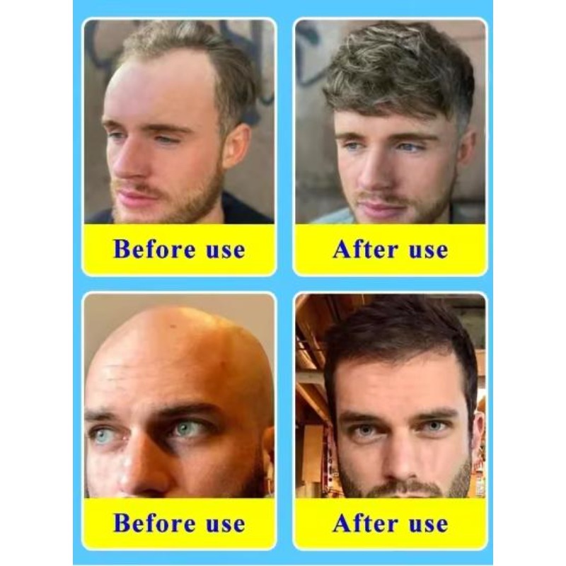 Biotin Collagen Hair Care Esse - đánh giá và giá Hair Care Vitamin