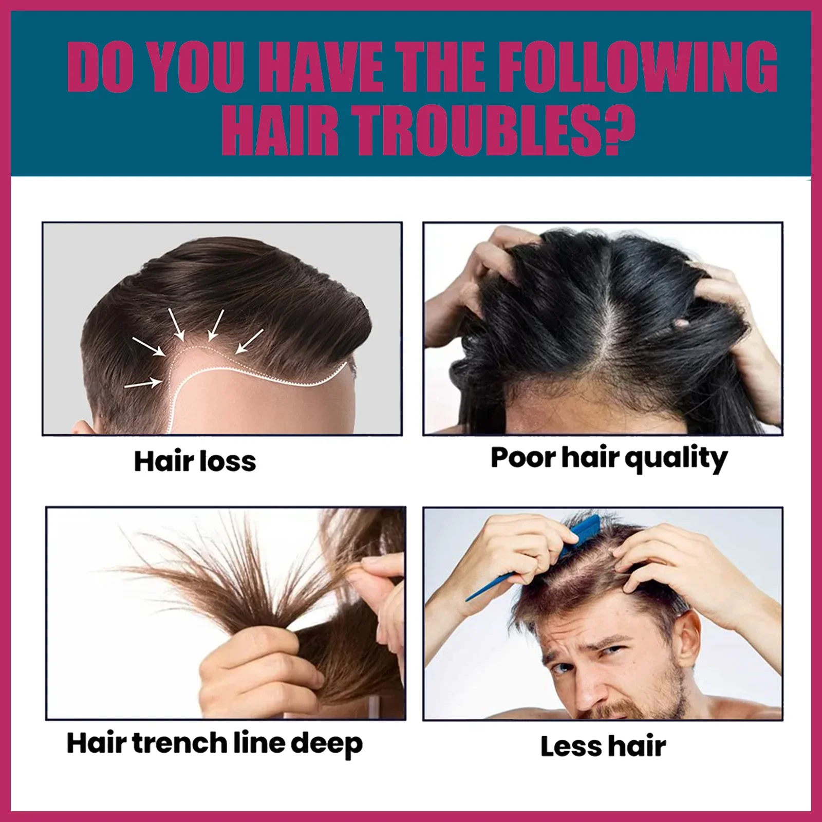 Biotin Collagen Hair Care Esse - đánh giá và giá Hair Care Vitamin