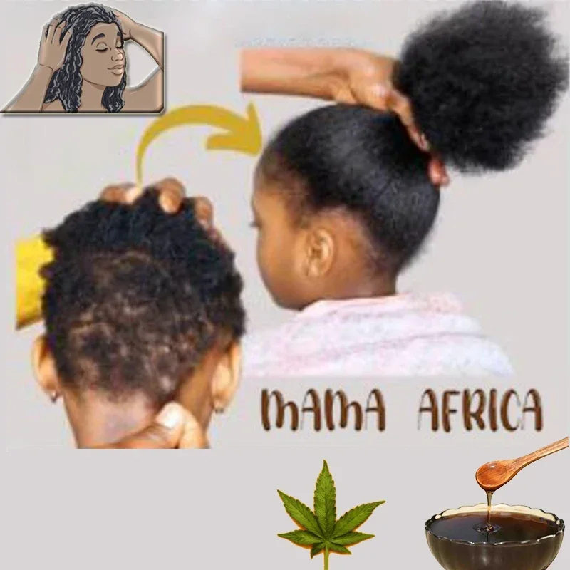 Africa Women Traction Alopecia - đánh giá và giá Hair Care Ginseng