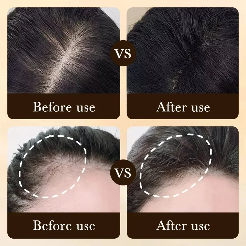 Biotin Fast Hair Growth Oil Pr - đánh giá và giá Hair Care Vitamin