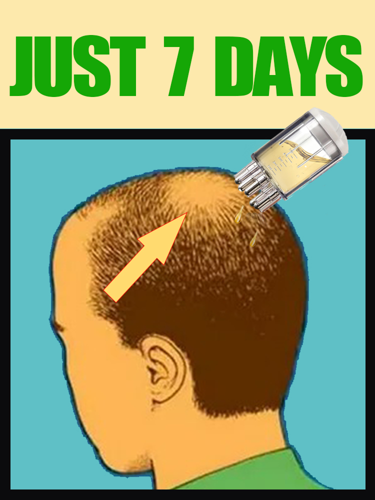 2025 NEW UPGRADE Scalp Applica - đánh giá và giá Hair Growth Serum Oil