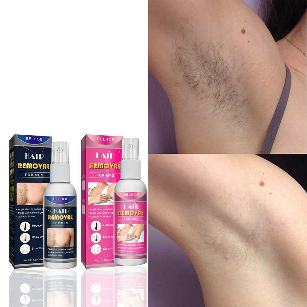 1/2PCS Super Natural Painless  - đánh giá và giá Hair Care Spray