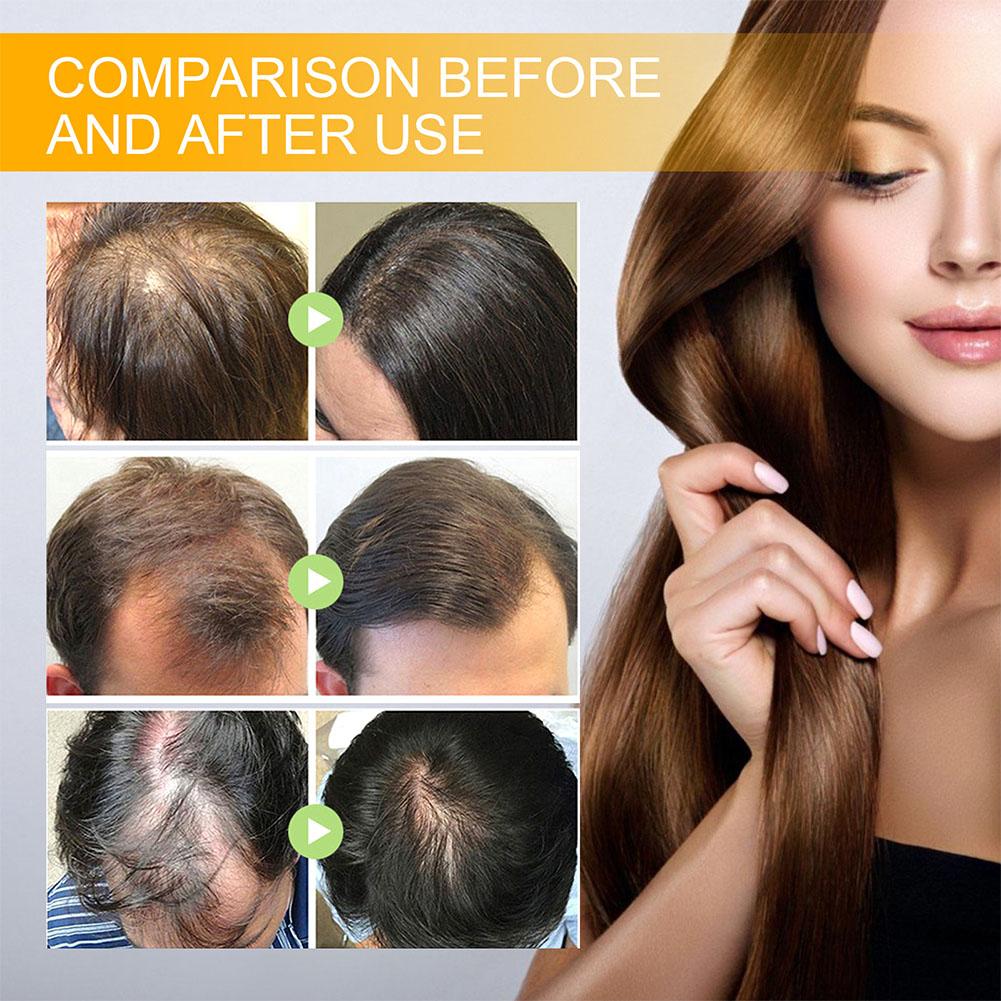 5/3/1pcs Biotin Fast Hair Grow - đánh giá và giá Hair Care Vitamin